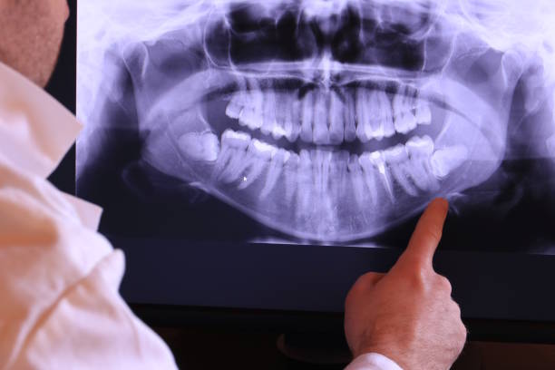 Tooth Infection Emergency Dentist in NM